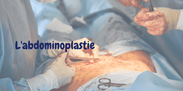 Abdominoplastie Chirurgie du ventre Lifting abdominal Redrapage abdominal Réduction de l'abdomen Correction de la paroi abdominale Plastie abdominale Amincissement du ventre Chirurgie esthétique de l'abdomen Réparation de la paroi abdominale