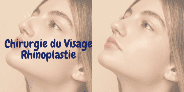 Rhinoplastie Chirurgie du nez Correction nasale Plastie nasale Refonte du nez Esthétique nasale Chirurgie esthétique du nez Réduction nasale Augmentation nasale Reconstruction nasale